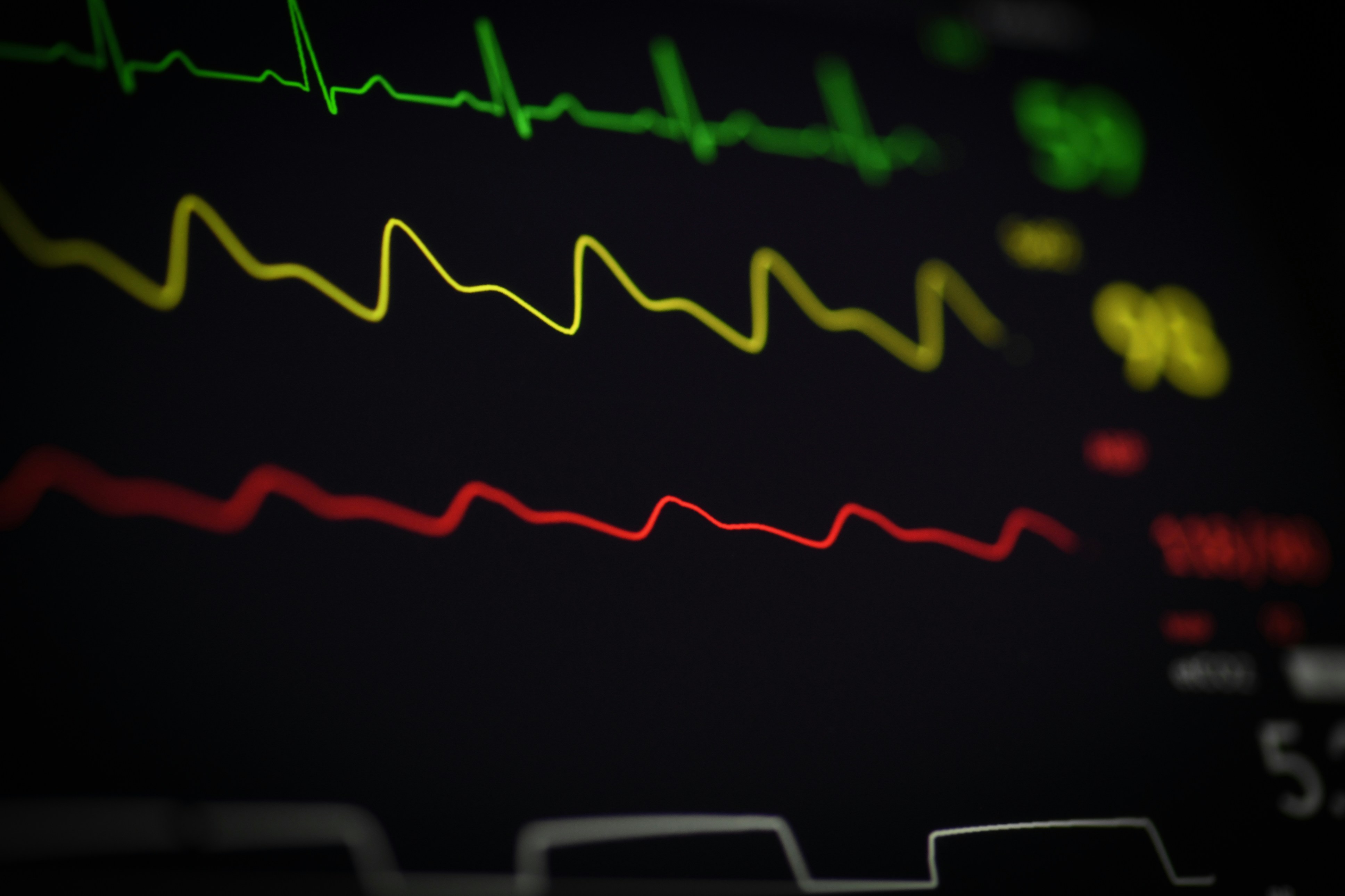 Heart rate on a monitor. 